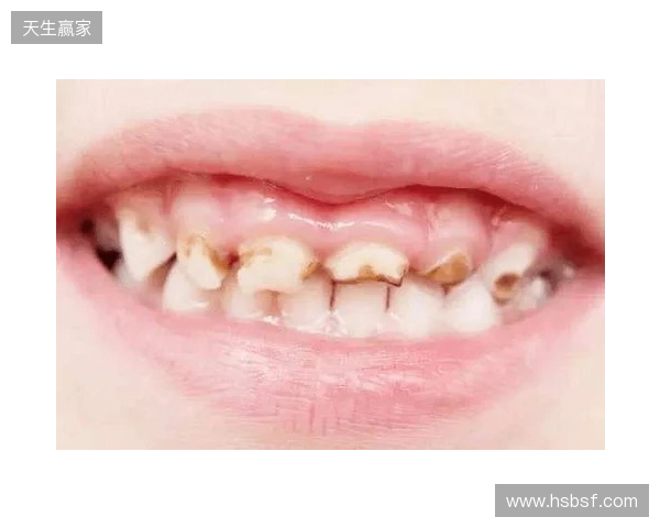 韦林顿确诊上唇部贯通伤;11、21牙半脱位;上颌前牙区牙槽骨骨折 韦林顿确诊上唇部贯通伤;11、21牙半脱位;上颌前牙区牙槽骨骨折